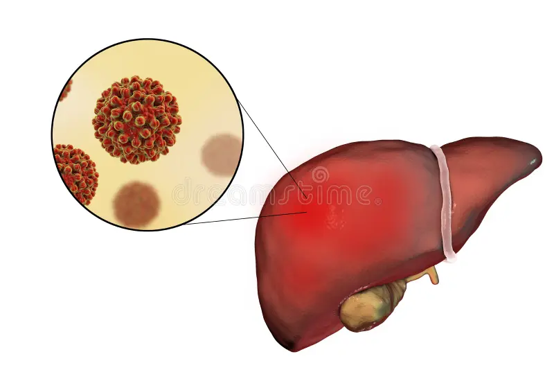 Pekan Hepatitis B (4–12 September): Saatnya Kenali, Cegah, dan Lindungi Diri